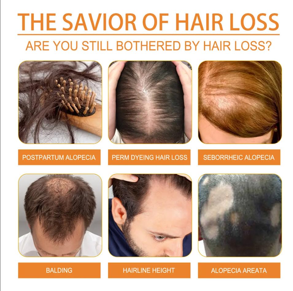 100% Pure Cold-Pressed Pumpkin Seed Oil for Hair Growth & Scalp Care – Unrefined, Rich in Zinc, Omega Fatty Acids & Antioxidants – Nourishes Scalp, Strengthens Hair, Reduces Shedding (2 fl oz)