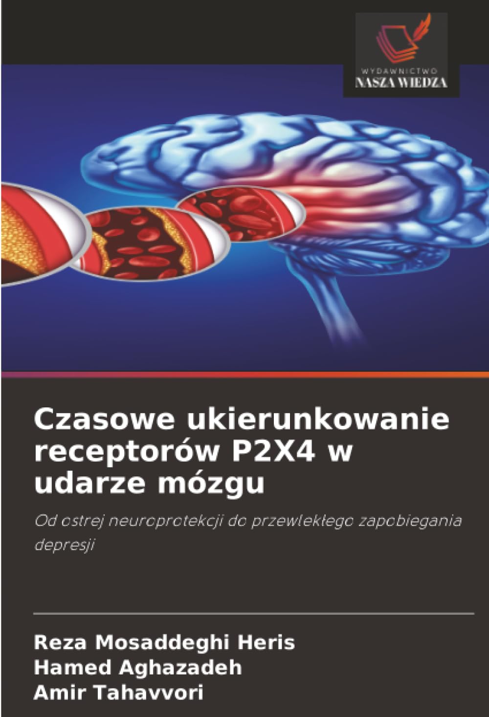 Czasowe ukierunkowanie receptorów P2X4 w udarze mózgu: Od ostrej neuroprotekcji do przewlek¿ego zapobiegania depresji