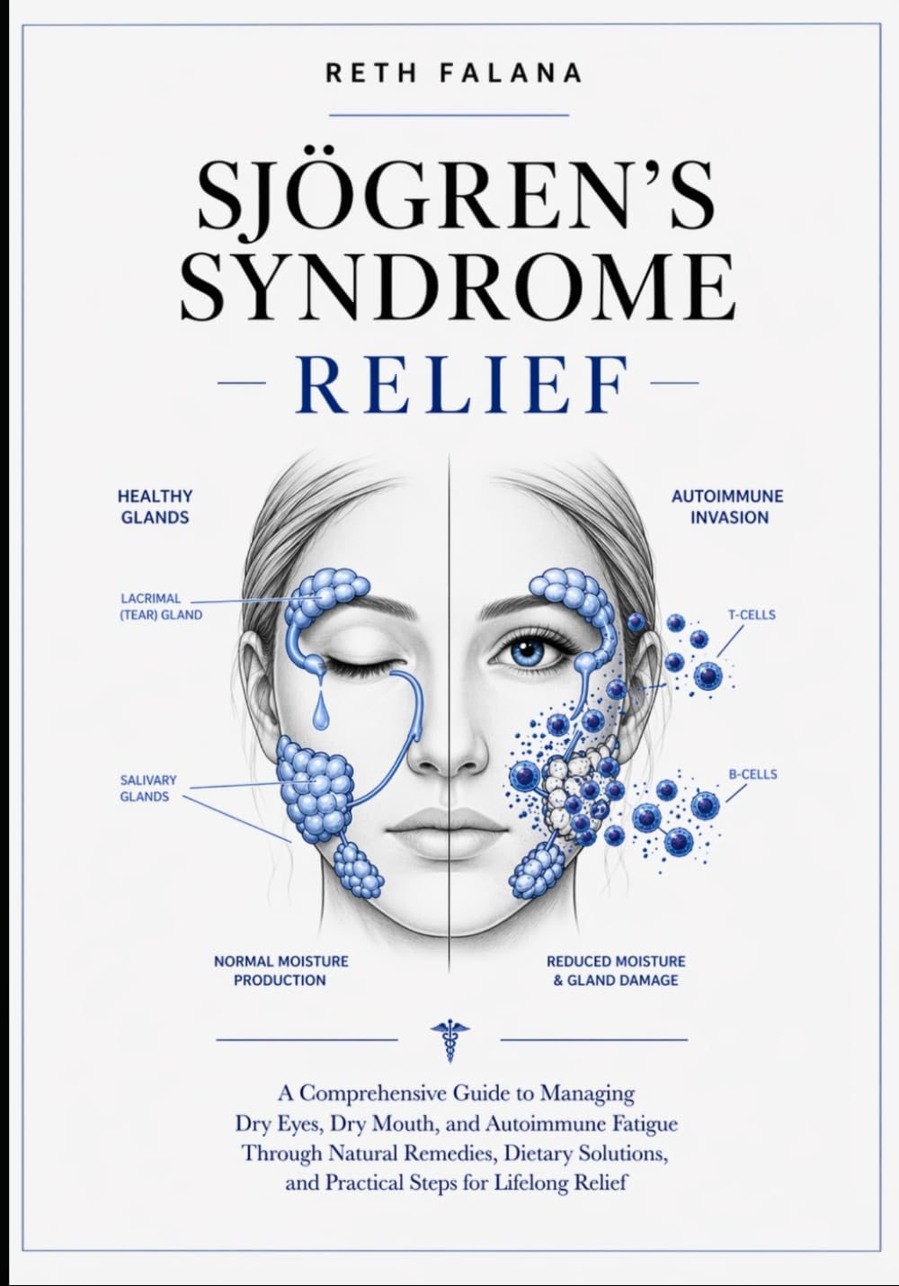 Sjögren’s Syndrome Relief: A Comprehensive Guide to Managing Dry Eyes, Dry Mouth, and Autoimmune Fatigue Through Natural Remedies, Dietary Solutions, ... Health and Chronic Disease Management Series)