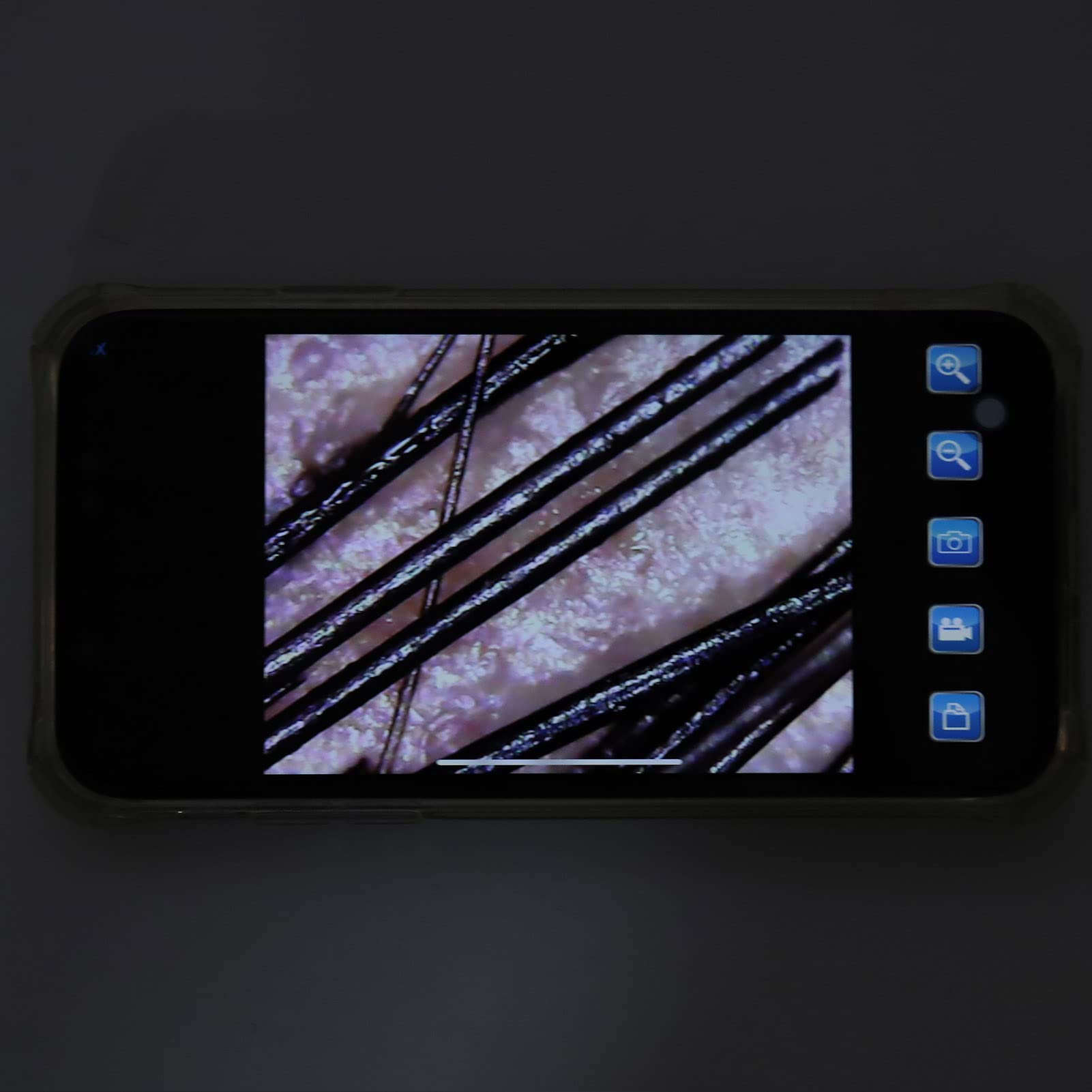 Détecteur de poils WiFi, Caméra Microscope Numérique sans fil 800X, Analyseur de follicules pileux, Microscope beauté