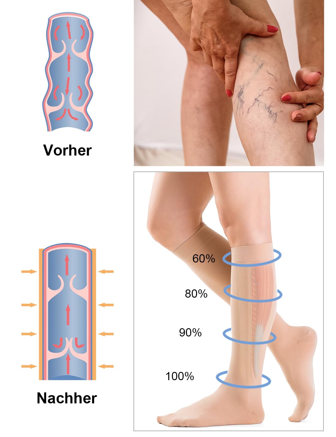Medicale Bas de Contention Femme et Homme 20-30mmhg Classe 2, Soutien Graduel Chaussettes de Contention pour Les varices, l'œdème, Vol de Voyage - 3