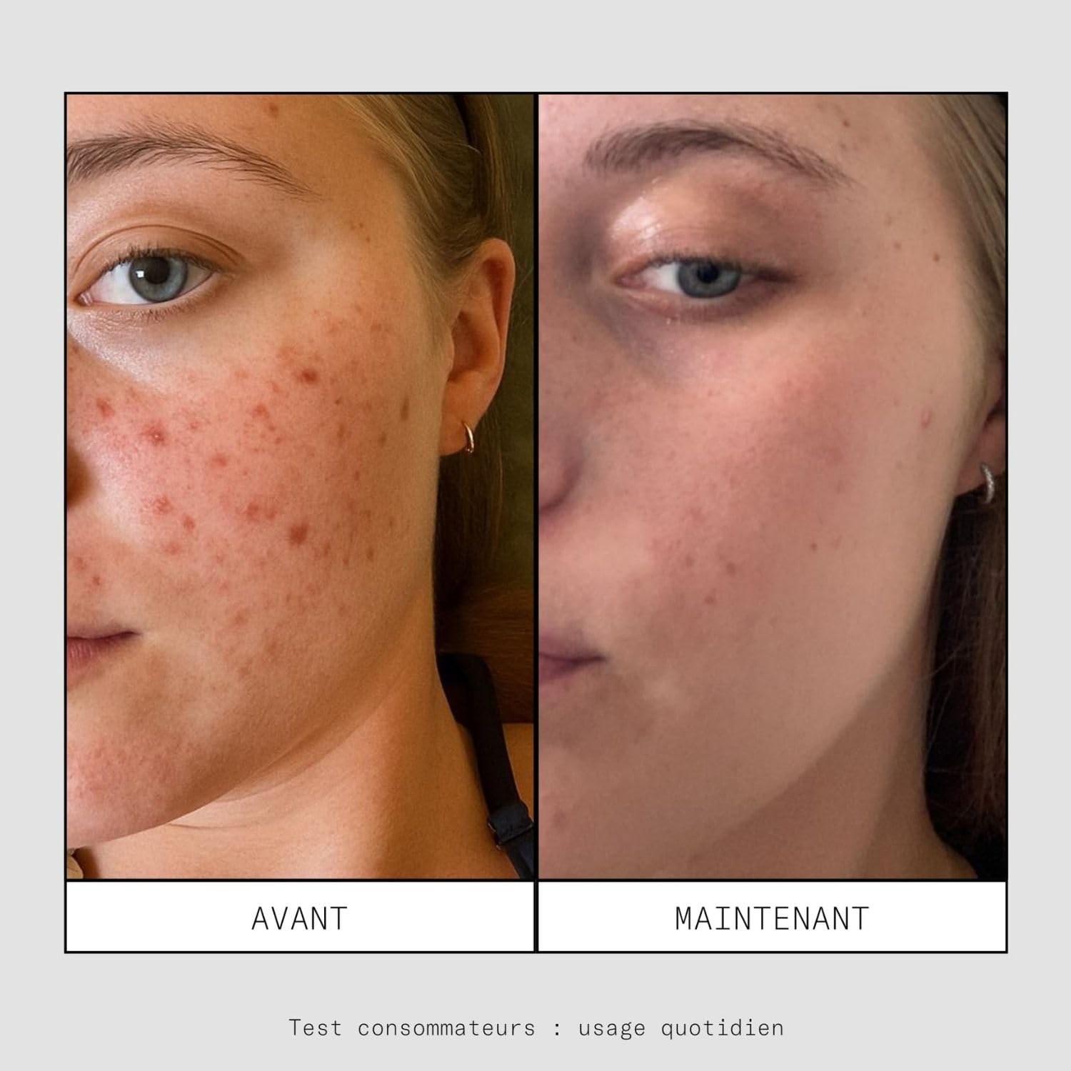 Skin & Out – Crème Hydratante Peaux Mixtes à Grasses – 99% d’Origine Naturelle – Hydrate, Apaise les boutons, Régule le Sébum – Fini non gras