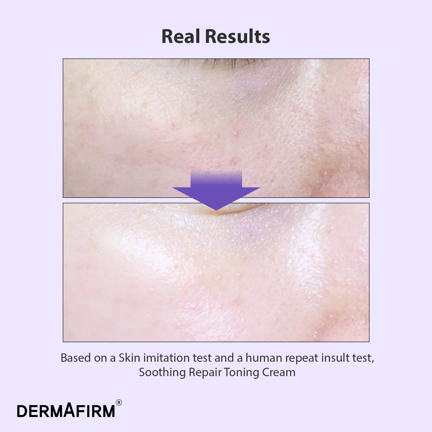 Dermafirm Soothing Repair Toning Cream - Korean Skin Care Moisturizer Face Cream w/Niacinamide, Bakuchiol, Glutathione & 8x Hyaluronic Acid - Vegan Glowing Skin Firming Cream (1.69 fl oz) - Image 2