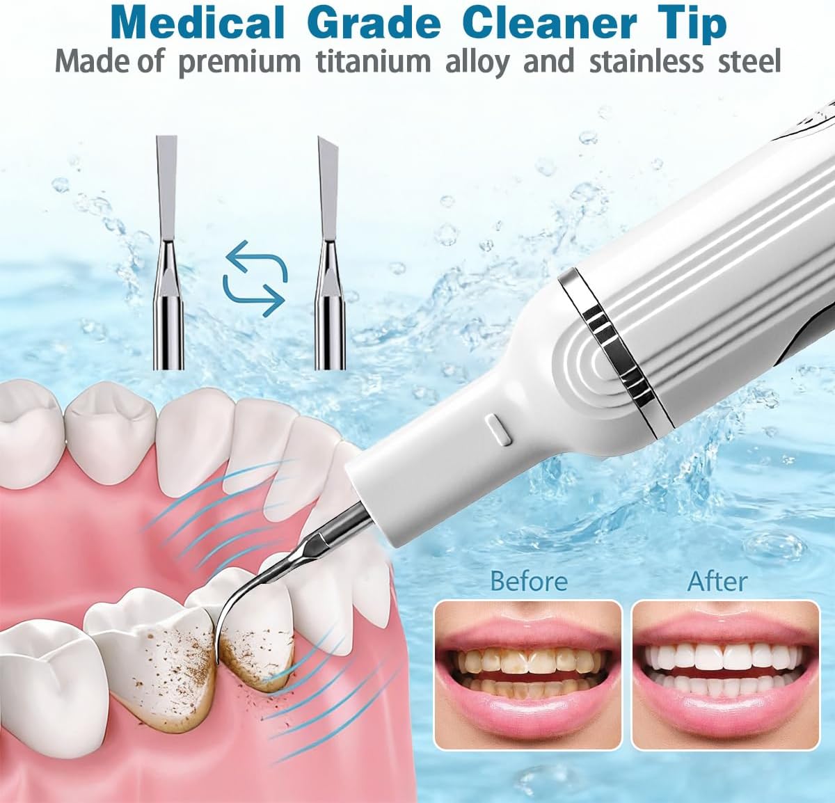 Ultimate Electric Teeth Cleaner - Ultrasonic Tooth Cleaning, Violet Light Protection, 316F Stainless Steel Heads, 5-Speed Modes, IPX6 Waterproof, Oral Care Kit with 11 Accessories‌ (White)
