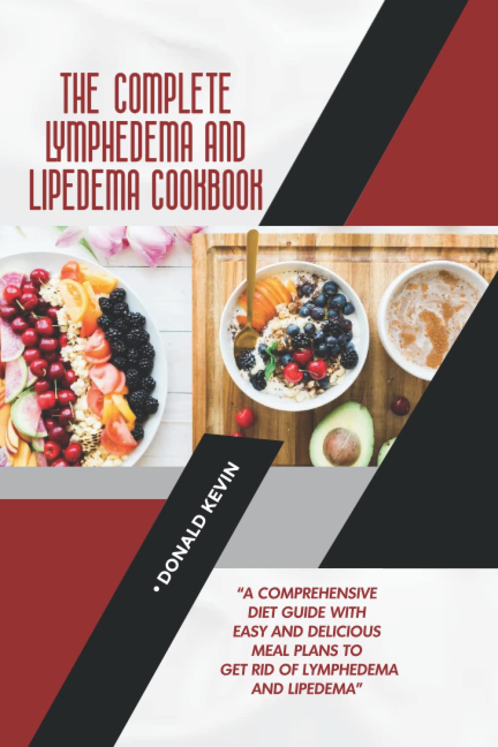 The Complete Lymphedema and Lipedema Cookbook: A Comprehensive Diet Guide With Easy and Delicious Meal Plans To Get Rid Of Lymphedema and Lipedema
