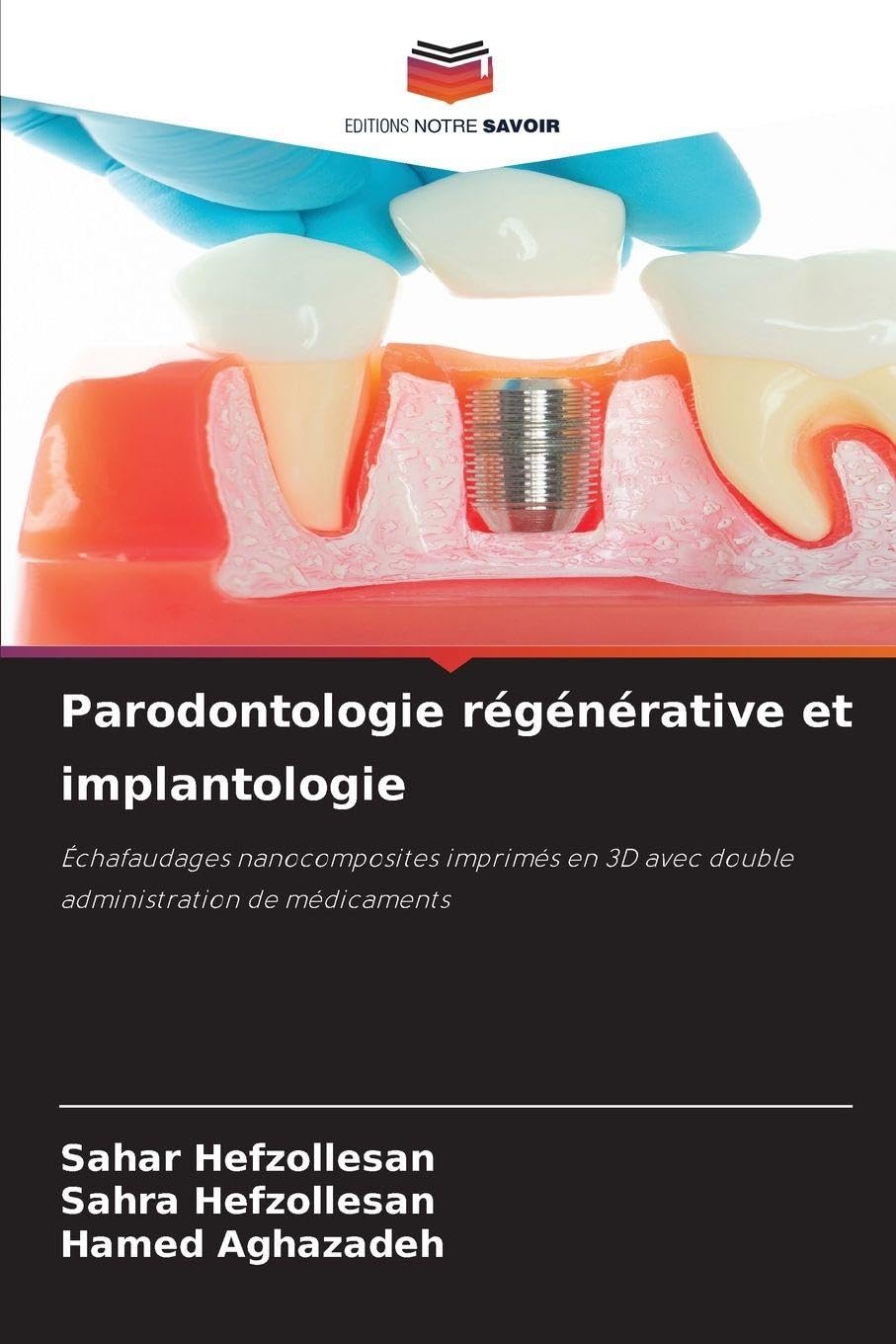Parodontologie régénérative et implantologie: Échafaudages nanocomposites imprimés en 3D avec double administration de médicaments