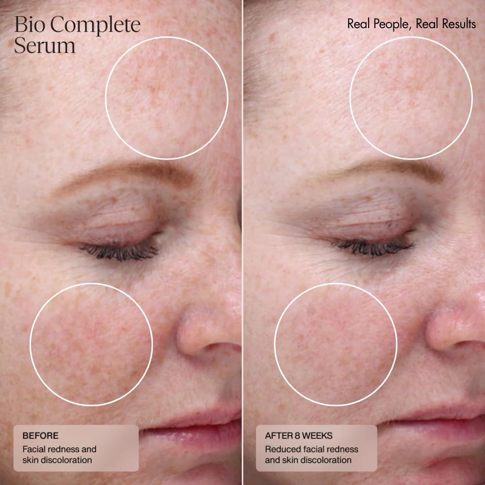 Senté Bio Complete Serum | Retinoid Serum for Sensitive Skin | Gentle, Nourishing & Hydrating | Combats Dull and Aging Skin | 1.0 Fl Oz