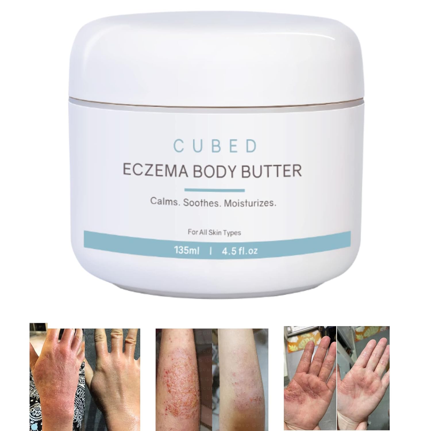Cubed 4.5 oz Eczema Cream for Adults, Eczema Relief