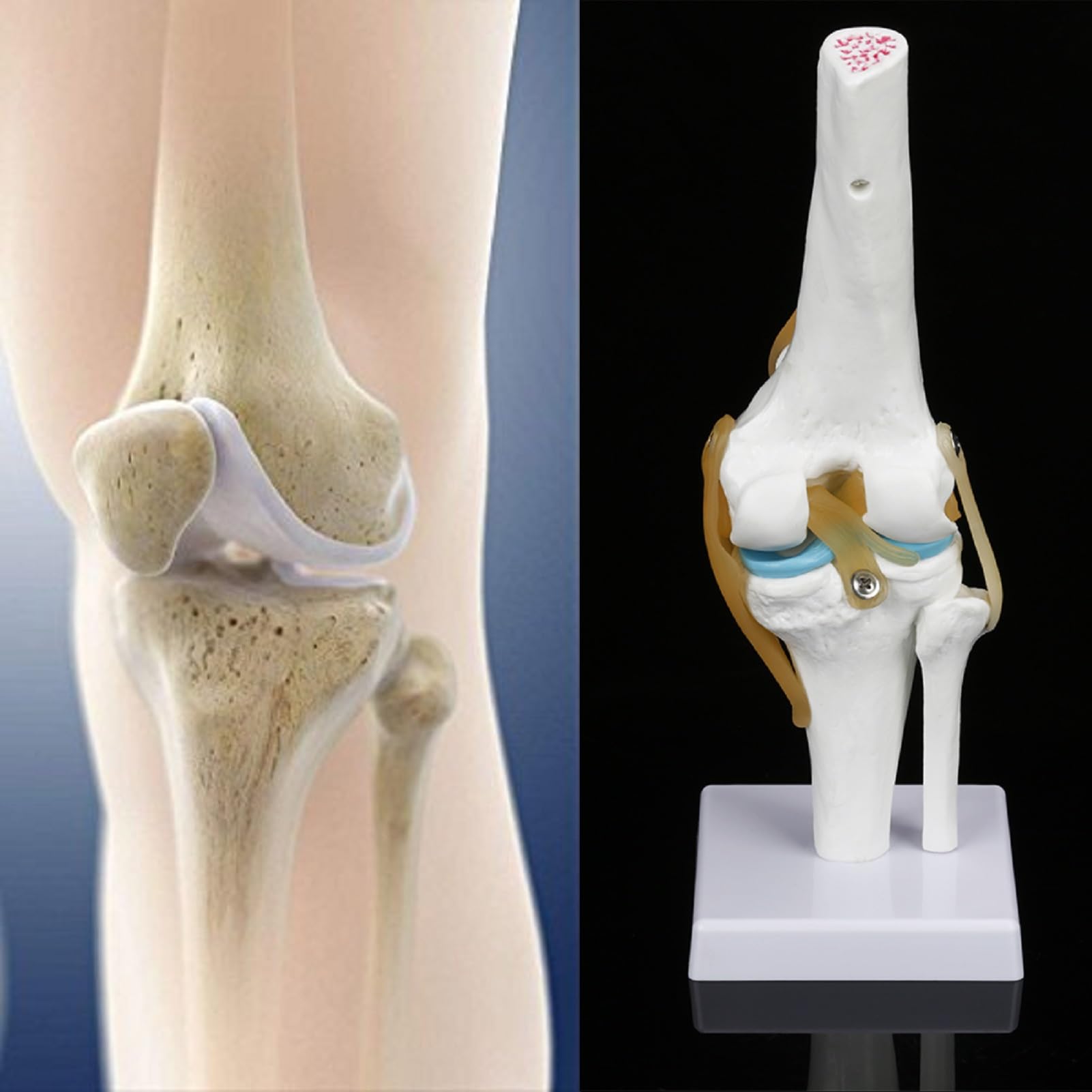 Anatomie Modell Kniegelenk, Skelett Lebensgroß Kniegelenkmodell Menschliches mit Ligamen, 3D Orthopädische Knie Modell für Medizinisches Lehren, Klinik-Demonstration, Lern- und Bildungsanzeigetools