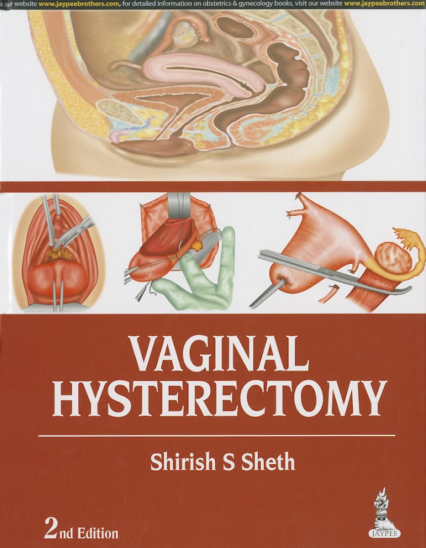 Vaginal Hysterectomy      2nd Edition