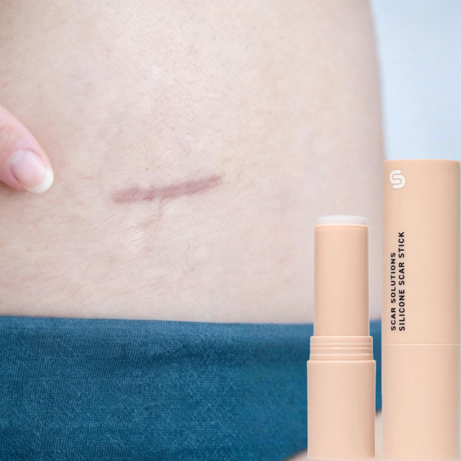 DermaSmooth, stick per cicatrici in silicone, erba di tigre e vitamina E, cura mirata delle cicatrici, versatile, liscia, applicabile, delicata, per tutti i tipi di pelle (2 pezzi)
