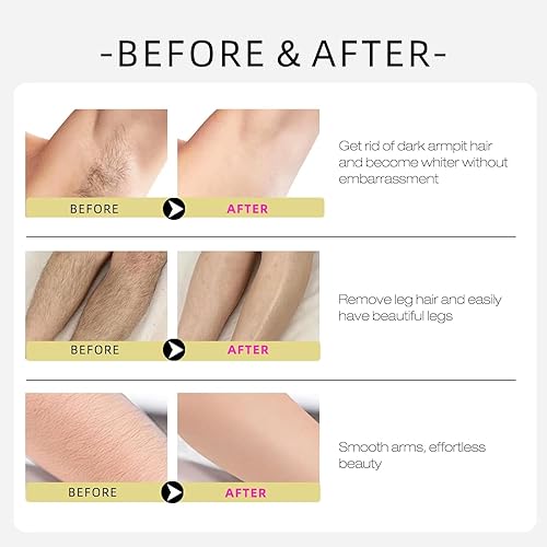 Miniatura 4 de Cyperus Rotundus, aceite natural de rotundus para depilación, reduce el crecimiento no deseado del cabello, hidratante y calmante Cyperus para