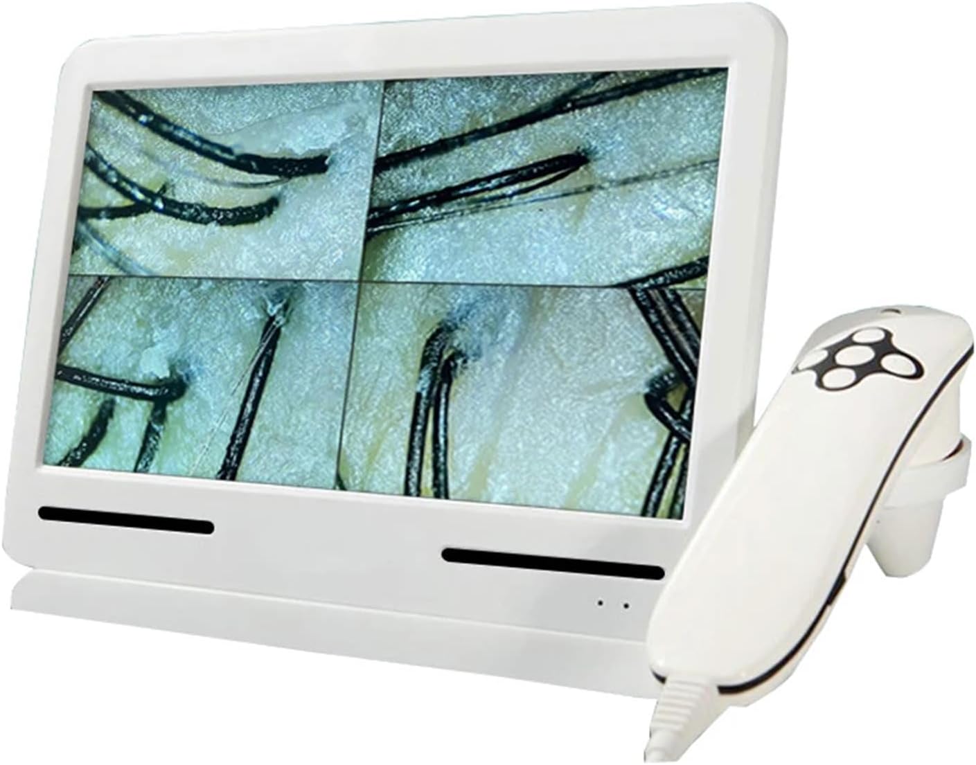 Scalp Analysis Machine, 10 Inch Professionele Huiddiagnose Haaranalysator 50X/200X Scalp Camera Haarmicroscoop Vergrootglas voor Salon & Beauty Center