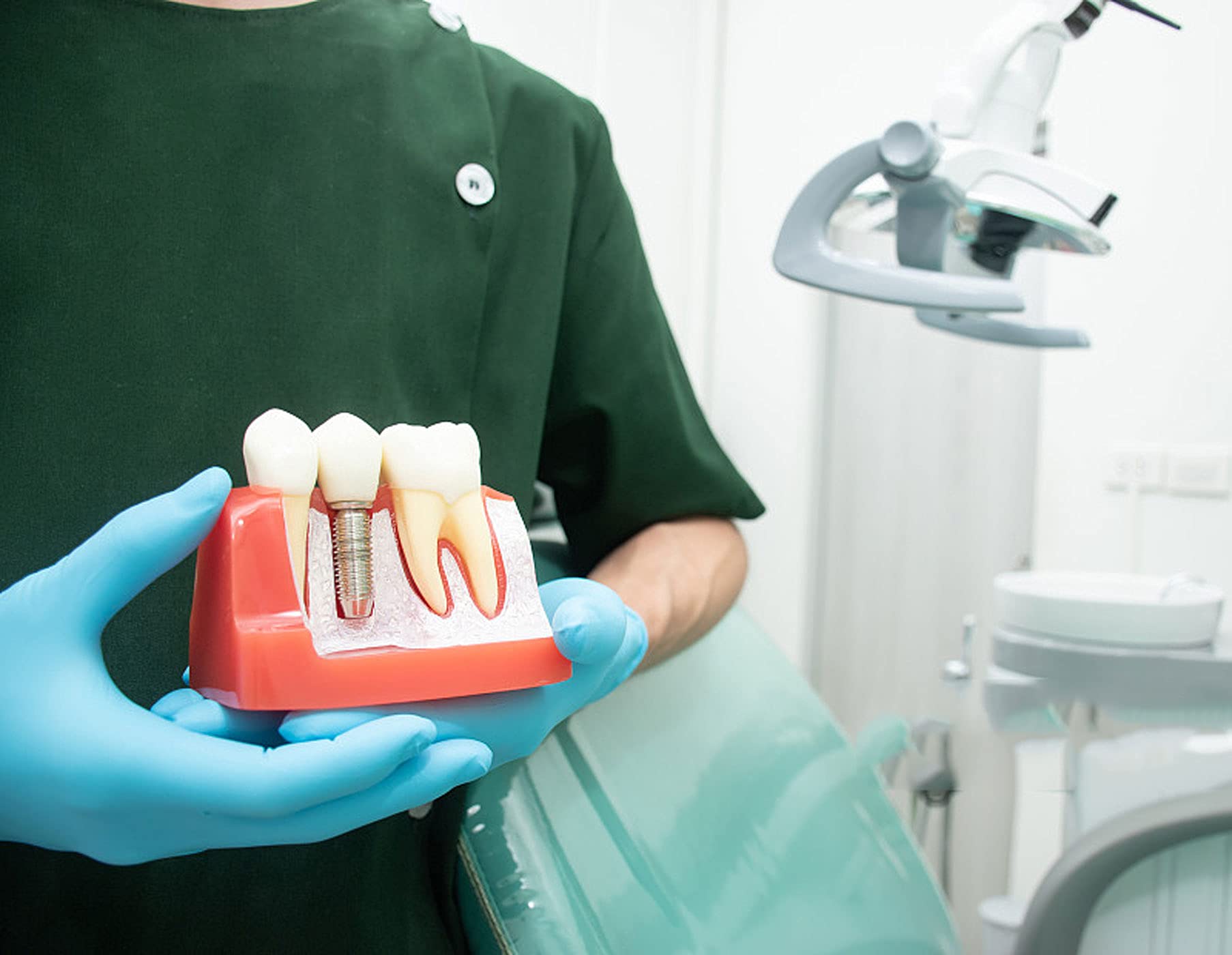 Archivo STL Modelo Dental 🦷 ·Modelo Para Descargar E Imprimir En 3D·Cults