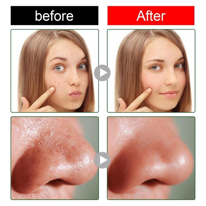 Miniatura 2 de Madi Kay Designs Máscara de té verde en barra removedor de puntos negros, control de aceite de limpieza profunda, hidratante eficaz, máscara para