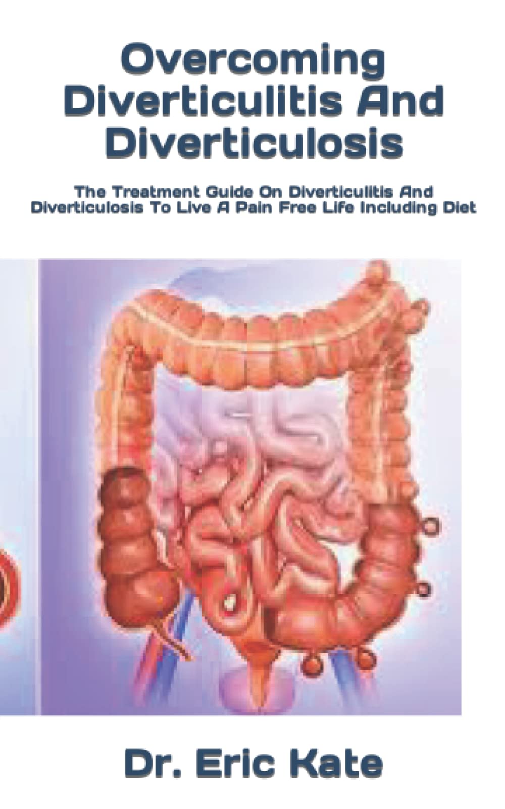 Buy Diverticulitis And Diverticulosis The Guide On