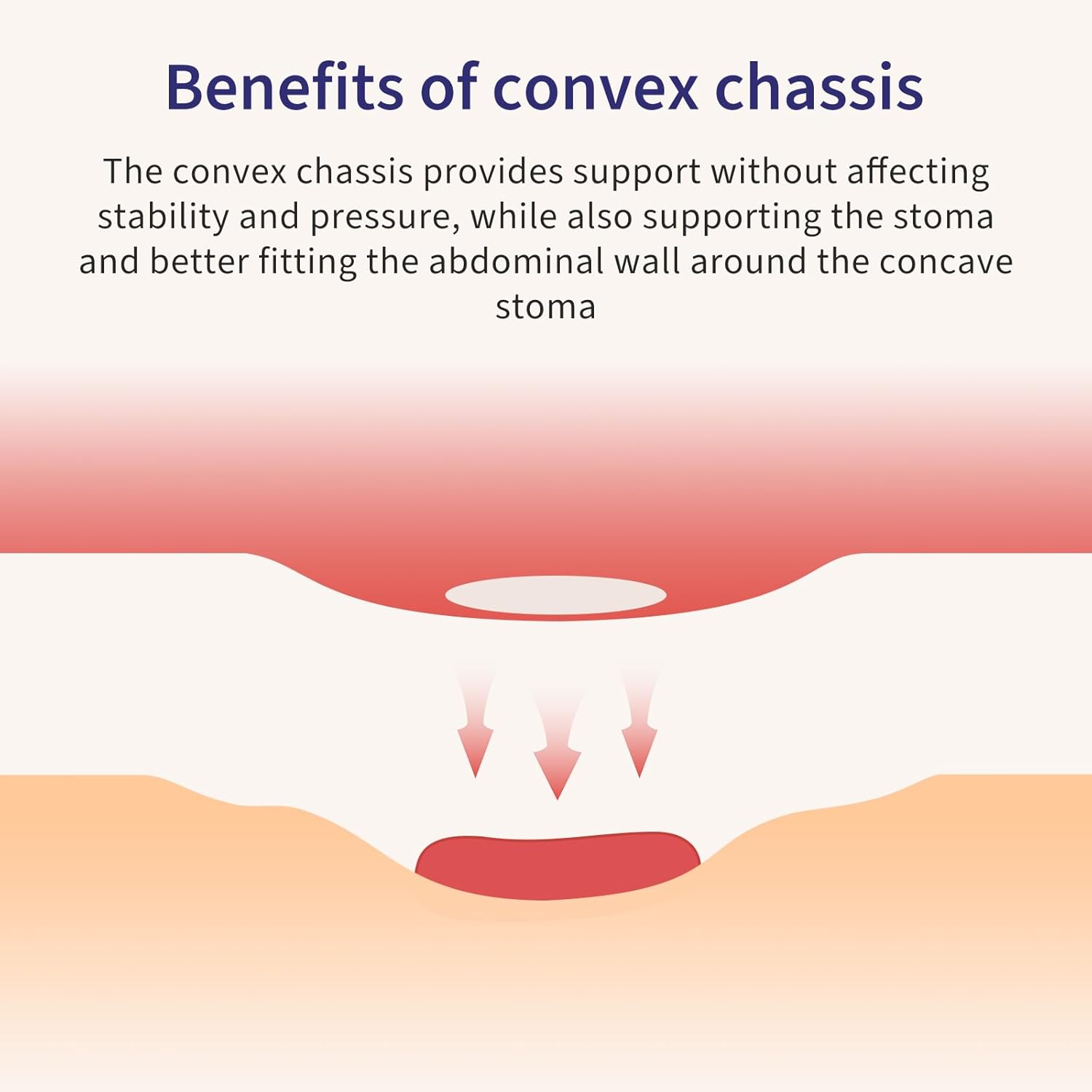 10 PCS Colostomy Bags Convex Ostomy Bag, One-Piece Ostomy Drain Pouches with A Belt for Irregular Stoma Uneven Wrinkled Skin, Max 45mm