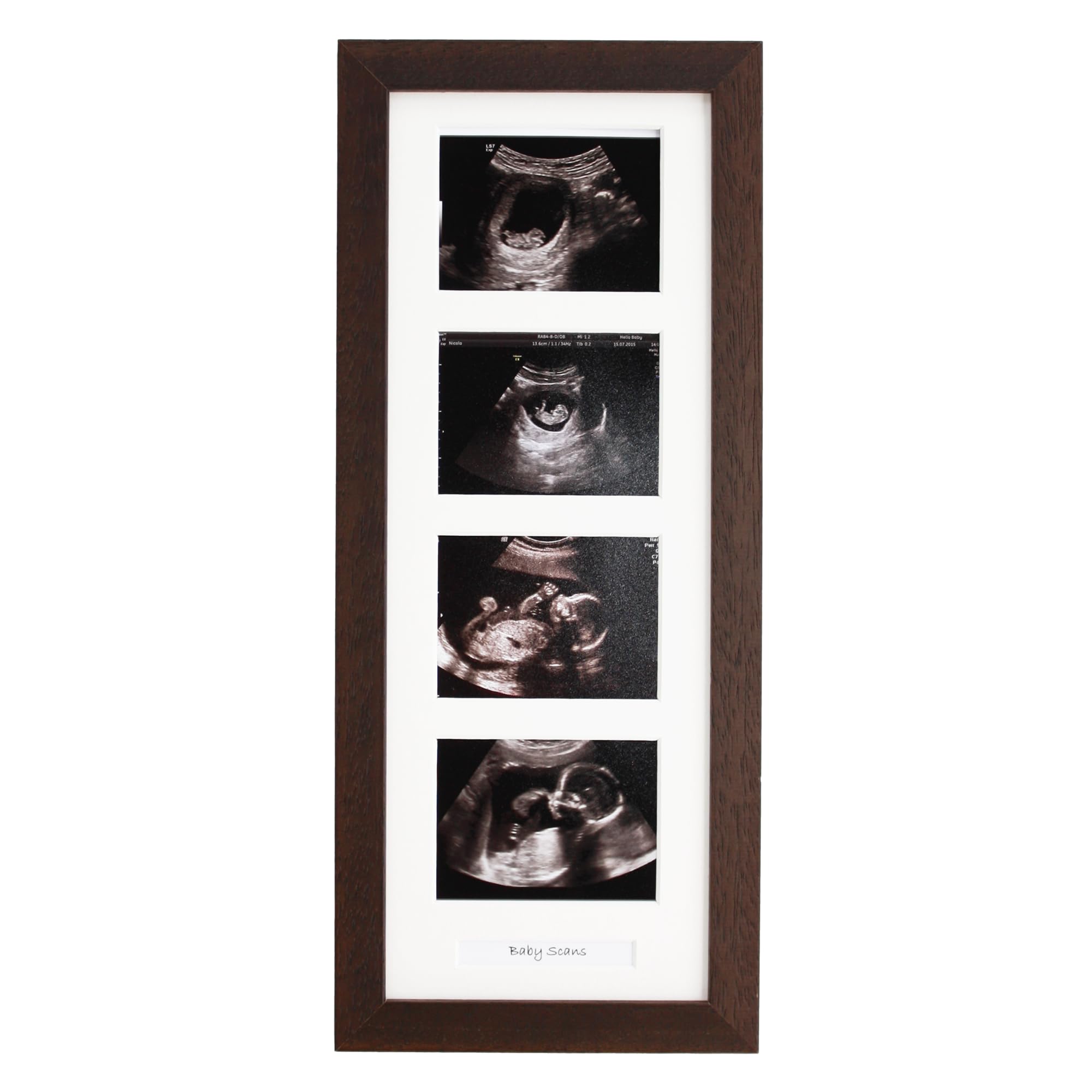 Baby Scan Photo Frame. Optional Personalisation. Multi Aperture Frame to display Four Ultra sound photos.Portrait. Pregnancy announcment | Baby Shower | Keepsake (Walnuit Frame)