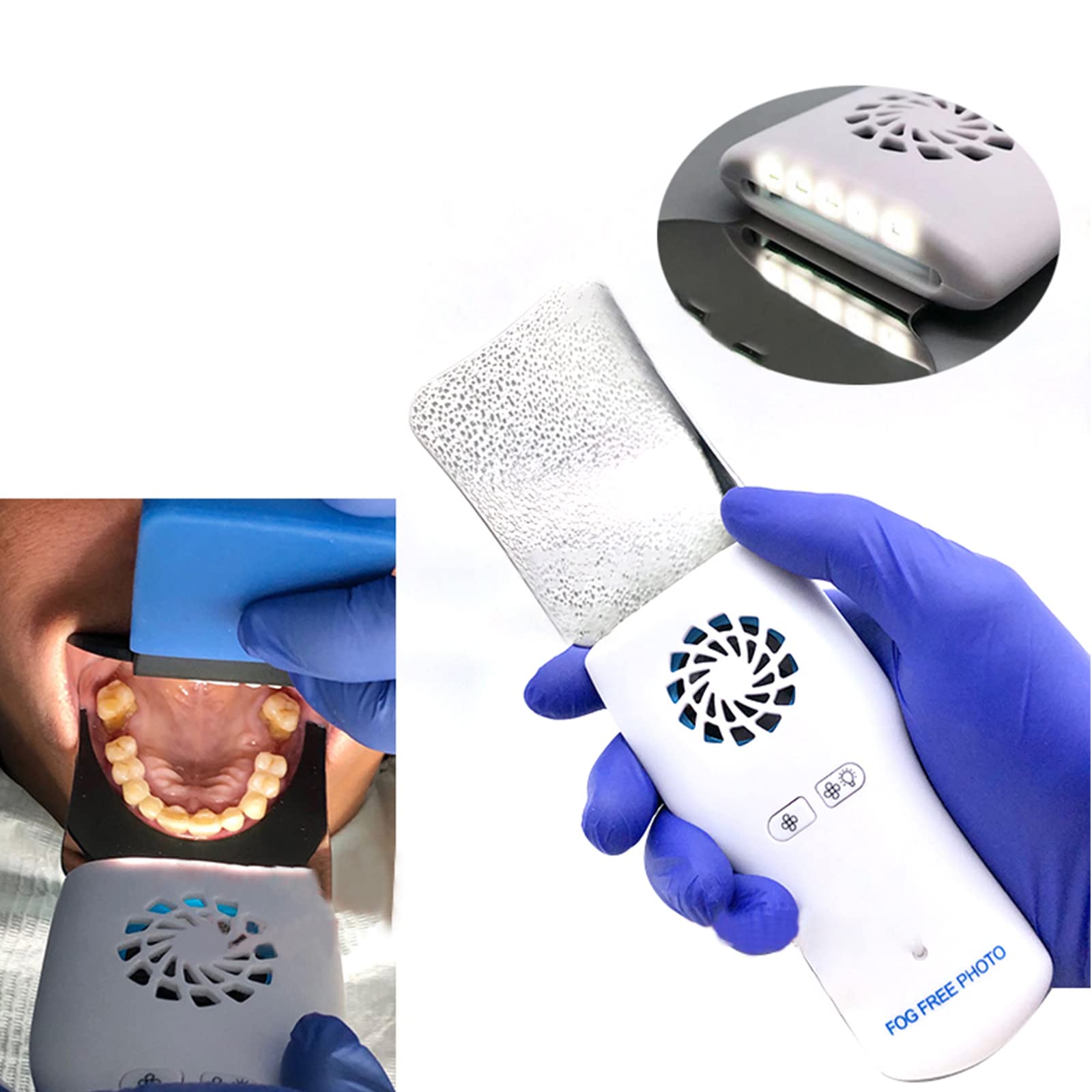 Specchio Fotografico occlusale Dentale per la Bocca, riflettore Fotografico intraorale in Vetro Placcato Dentale con 4 specchi intercambiabili, Specchio Fotografico riflettore ortodontico in Acciaio