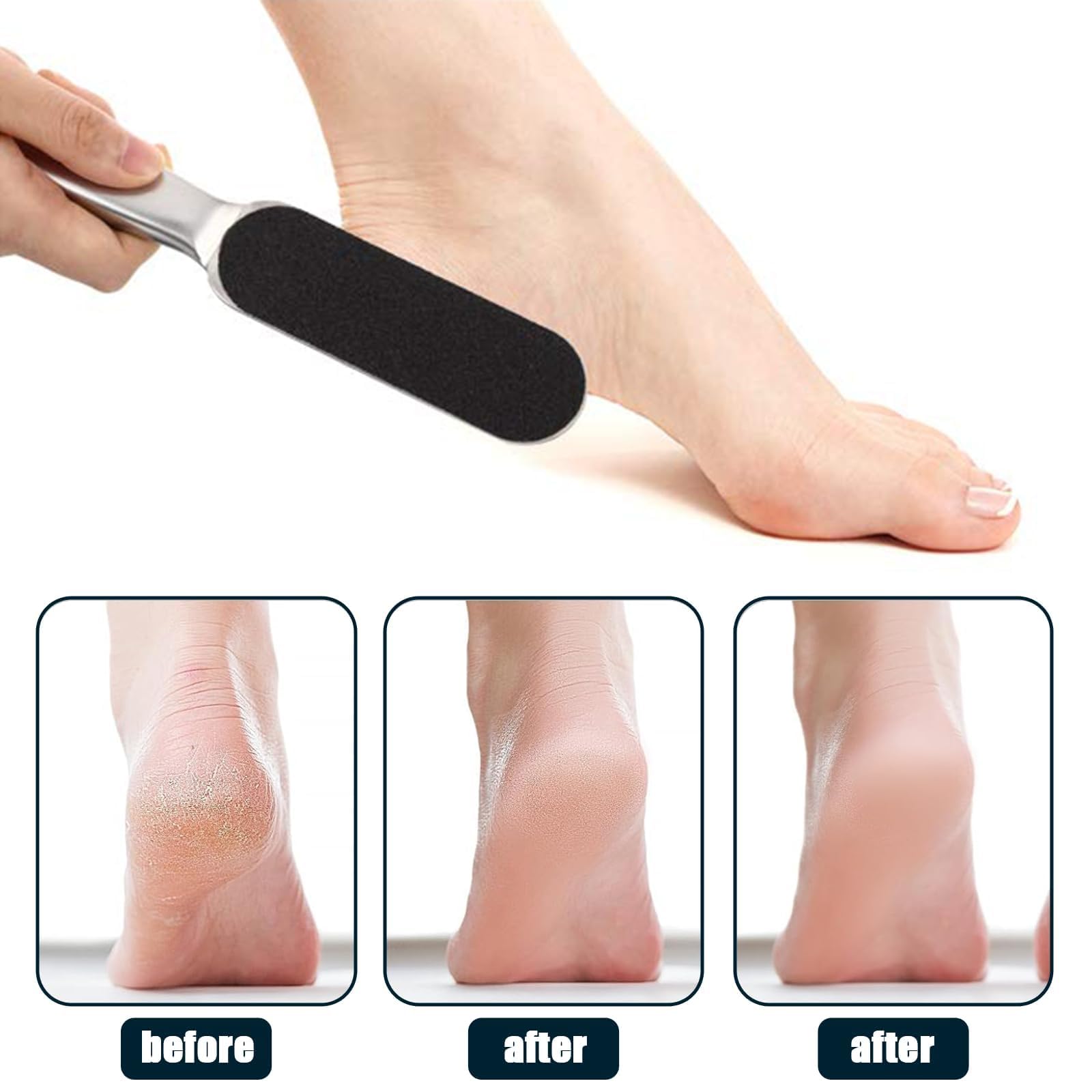 Professional Stainless Steel Foot File with 20pcs Foot File Coarse Fine Grit Pads, Foot Grater, Pedicure Tools Kit - Image 3