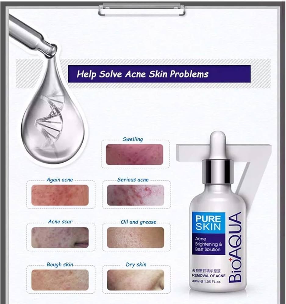 Bioaqua Serum Pure Skin Retira Acne Y Espinillas Regenera : Amazon.com.mx:  Belleza