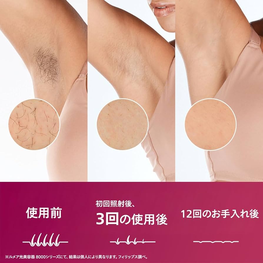 値下げ中⭕️【家庭用脱毛器】フィリップス PHILIPS 3アタッチメント付き Amazon | 【正規品】フィリップス 光美容器 ルメア 8000 男女