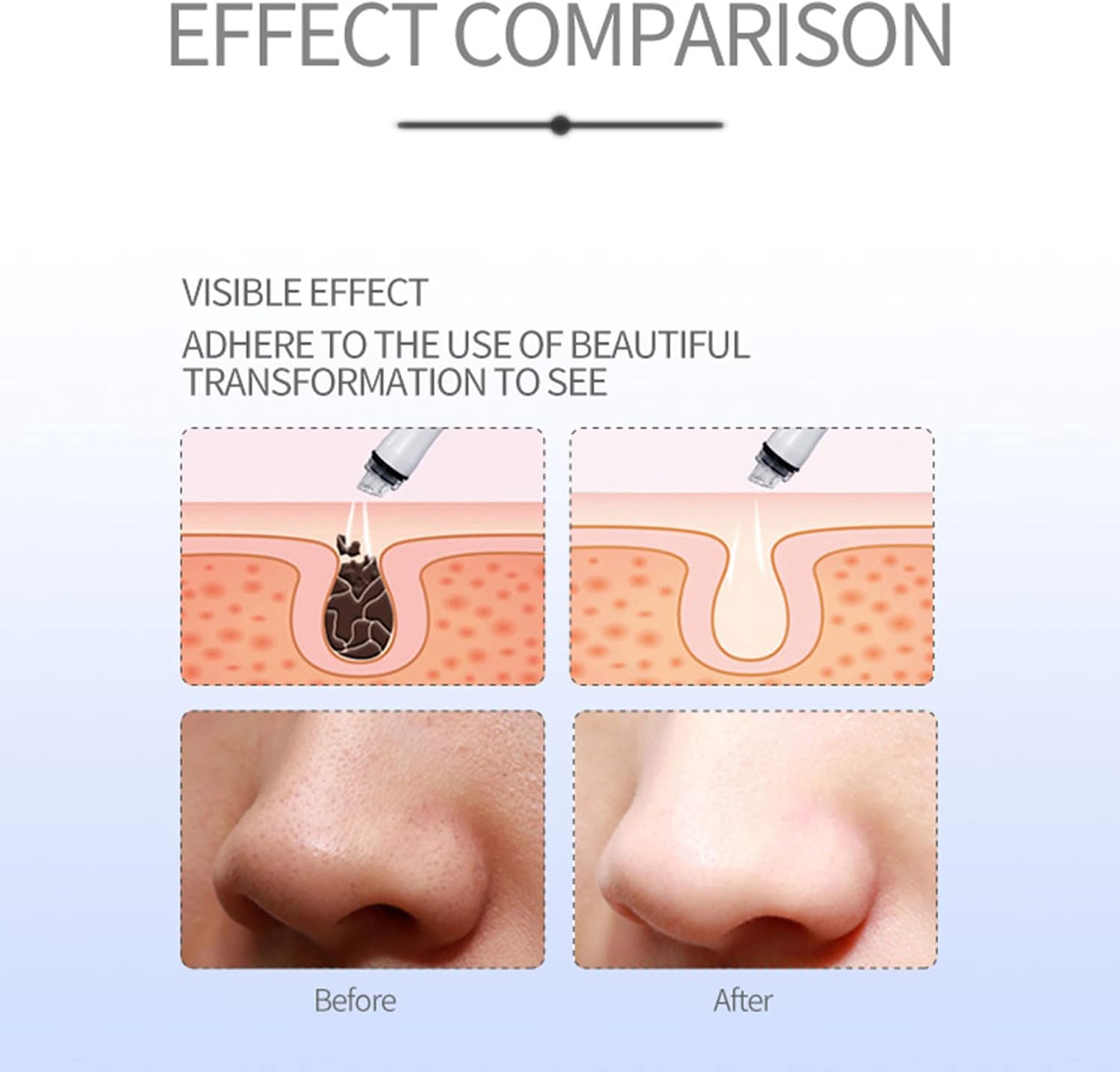 Acne Pore Cleaner, Facial Pore Cleaner, Electric Acne Comedy Blackhead Extractor Tool, with 5 Suctions, 4 Probes, Blackhead Removal Suction, for Women and Men (Blue) / N
