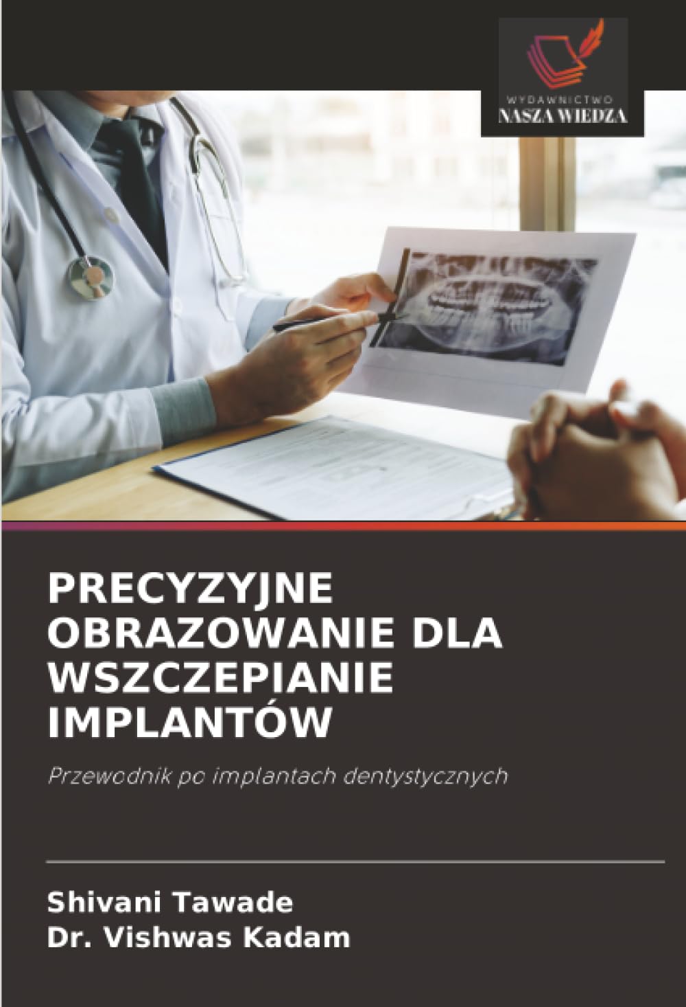 PRECYZYJNE OBRAZOWANIE DLA WSZCZEPIANIE IMPLANTÓW: Przewodnik po implantach dentystycznych