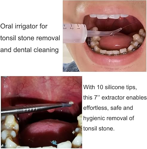Miniatura 4 de Airgoesin Herramienta de eliminación de piedras amígdalas de 8 piezas, removedor de placa de dientes, raspador de lengua, irrigador oral, limpieza