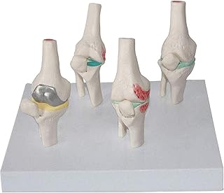 Study Model Human Knee Joint Anatomical Model Normal and Lesion Demonstration Knee Joint Anatomy Model Medical Teaching Tools Aid, Lab Office Ornament SaiFei