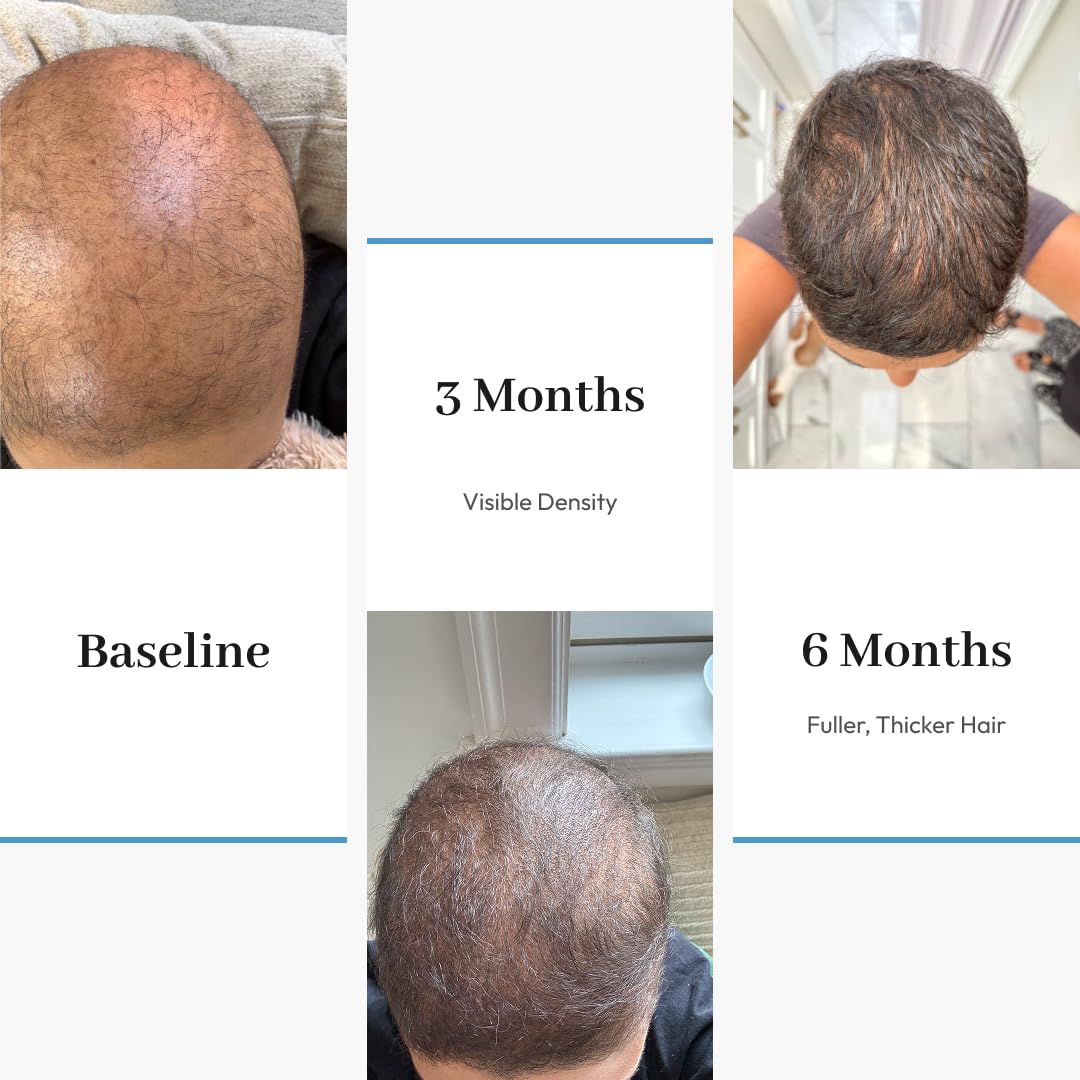 Przeciwstarzeniowe serum do włosów przetestowane klinicznie przywraca naturalny kolor włosów przywraca siwe włosy grubsze i pełniejsze włosy, nietoksyczne, odpowiednie do wszystkich rodzajów włosów 50