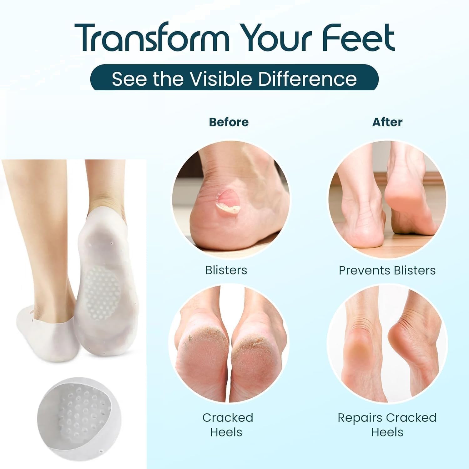 LUVINA Moisturizing Silicone Gel Socks with Arch Support – Dry Crack Feet Treatment for Women or Men, Hydrating Spa Socks for Heel Repair - Image 3 thumbnail
