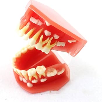 歯のモデル　発育模型 Amazon.co.jp: 子供の歯科模型、子供の乳歯の発育歯列モデル