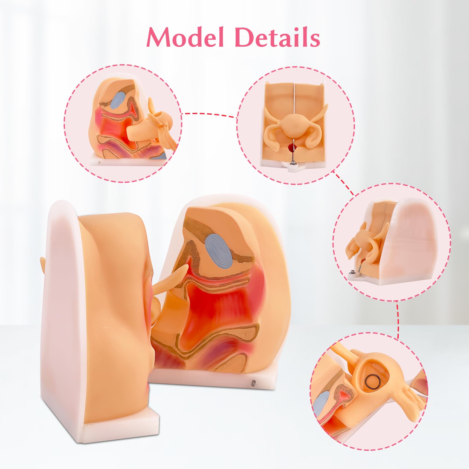Female Contraceptive & IUD Teaching Model - Anatomical Gynecological Demonstration Tool For Education