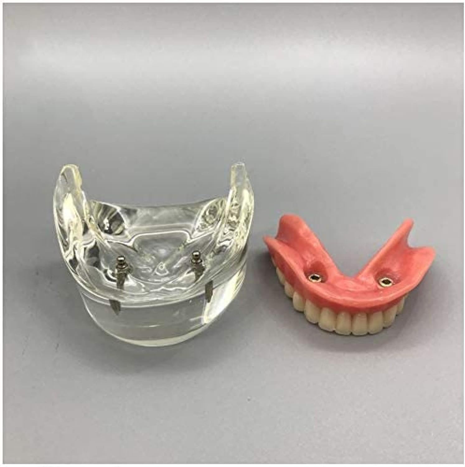 Modello Dentale - Impianto Dentale - Overdenture Inferiore Mandibolare 2 Impianti Demo Per L'insegnamento E Lo Studio