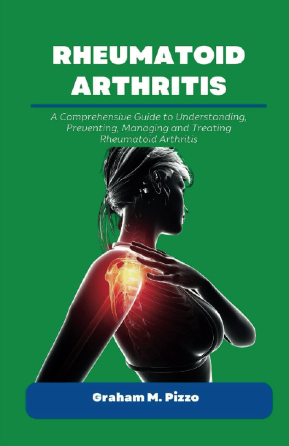 RHEUMATOID ARTHRITIS: A Comprehensive Guide to Understanding, Preventing, Managing and Treating Rheumatoid Arthritis