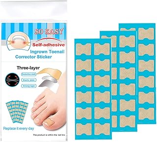 Adesivos corretores de unha encravada Adesivos de cuidados com os pés Adesivos sem cola para unhas dos pés Correção adesiva das unhas dos pés Tratamento de unhas dos dedos dos pés Pedicure Adesivo de