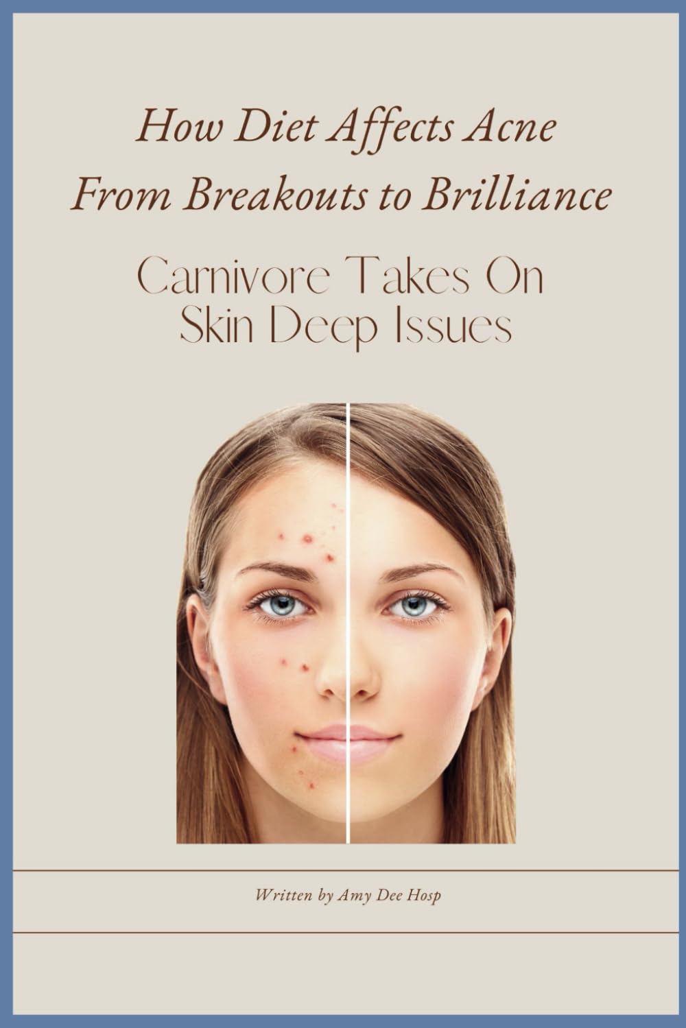 How Diet Affects Acne From Breakouts To Brilliance: Carnivore Takes On Skin Deep Issues