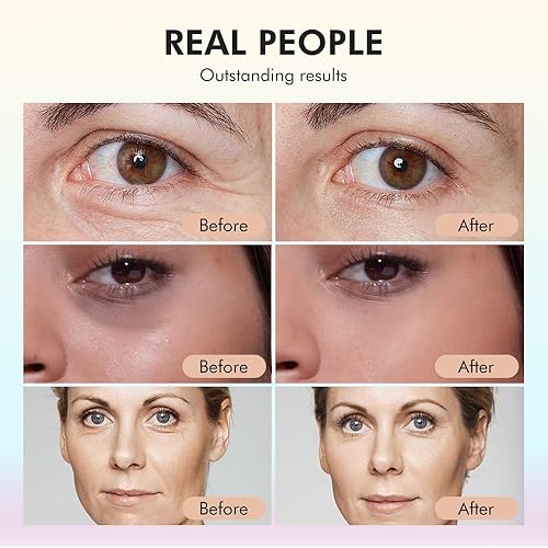 Miniatura 3 de Paquete de 2 sueros faciales, suero de retinol con vitamina C antienvejecimiento para cara con retinol y aminoácidos, aumenta el colágeno de la