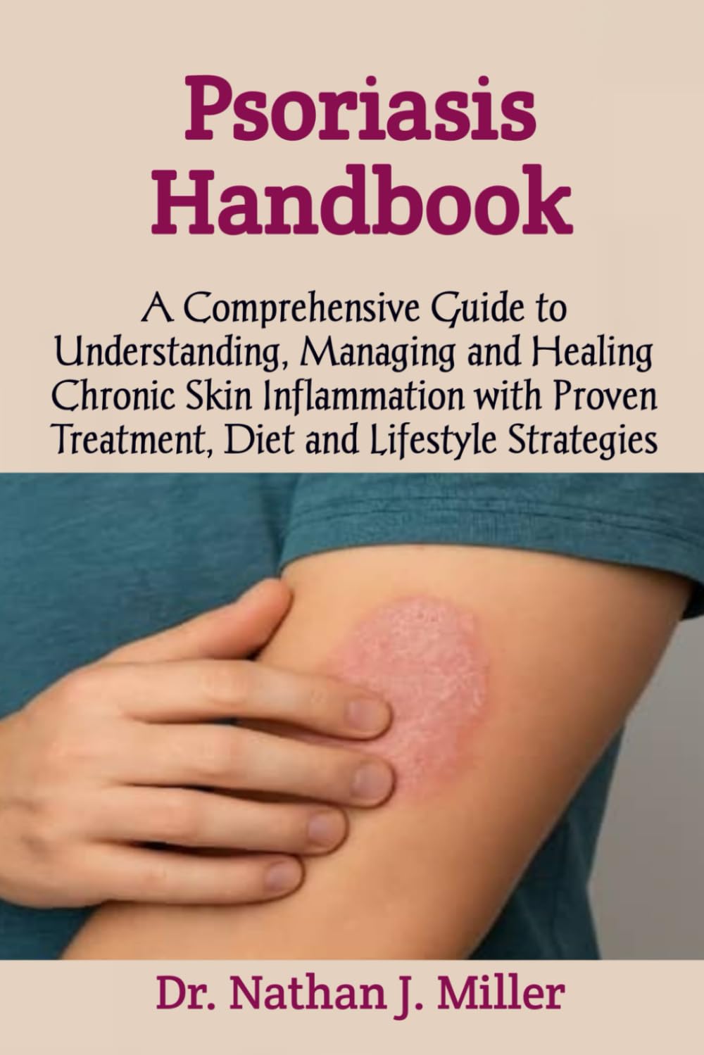 Psoriasis Handbook: A Comprehensive Guide to Understanding, Managing and Healing Chronic Skin Inflammation with Proven Treatment, Diet and Lifestyle Strategies