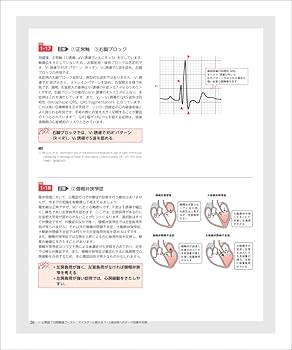 心電図7日間最強ブースト_心電図完全攻略マニュアル_\