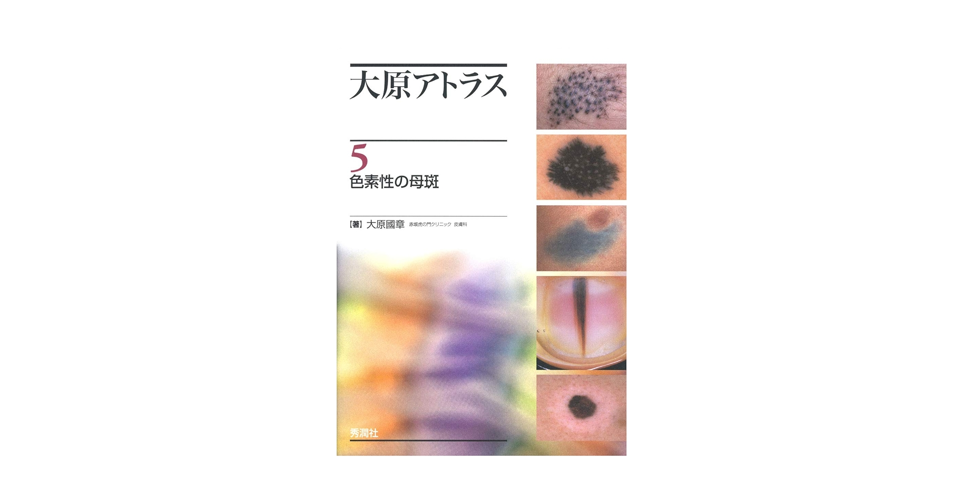 皮膚科診療カラーアトラス大系〈5〉 皮膚科診療カラーアトラス大系 （1）』（鈴木 啓之,神崎 保