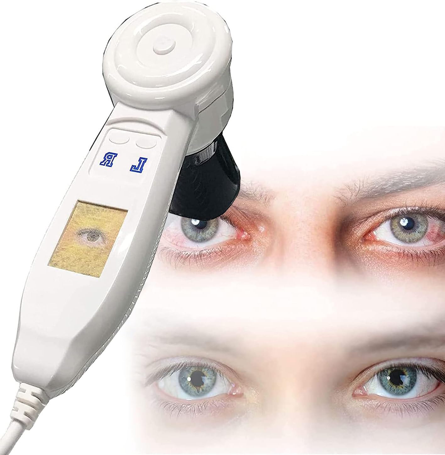 Przenośna kamera irydologiczna 5.0 MP USB HD 2 miliony pikseli Detektor tęczówki Lupa tęczówki Oprogramowanie Iris Analizator komputerowy Irydologia Kamera komputerowa 30X
