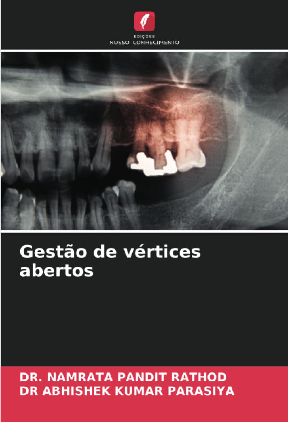Gestão de vértices abertos