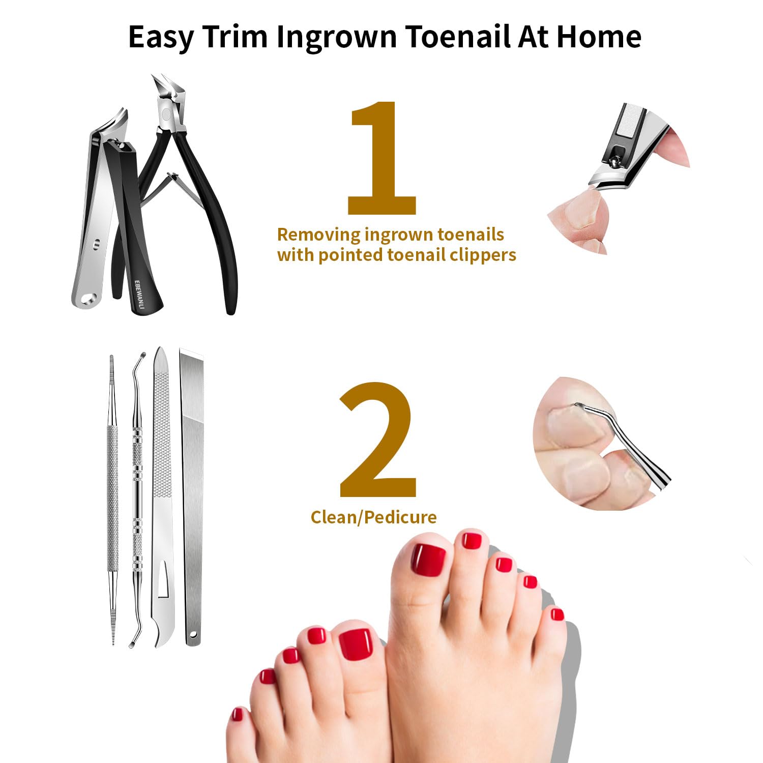 EBEWANLI Kit d'enlèvement d'ongle incarné, 6 pièces en acier inoxydable, kit pour ongles d'orteil avec coupe-ongles droits, obliques et incurvés pour ongles incarnés, outil de pédicure professionnel à