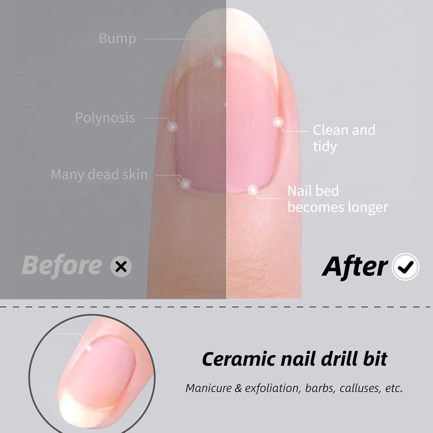 MEISO 5 Pezzi Punte Fresa Unghie, Punta da Trapano per Unghie, Rimozione Cuticola, Punte Fresa Unghie Ceramica per Rimuovere Gel, Acrilico, Cuticola, Strumenti per Manicure e Pedicure