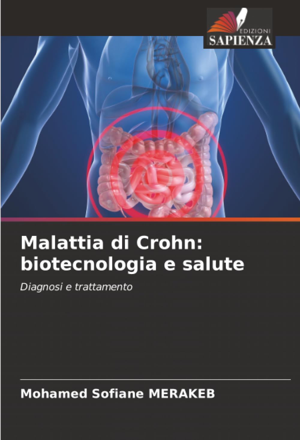 Malattia di Crohn: biotecnologia e salute: Diagnosi e trattamento