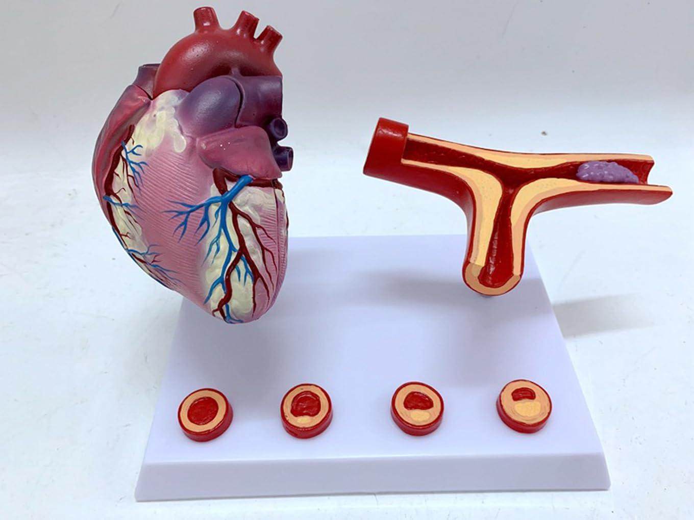 Narzędzia do nauki modelu, nauczanie anatomii serca serca pomostowanie tętnic wieńcowych model z blokadą tętnic i naczyń krwionośnych zakrzepica pomoce dydaktyczne
