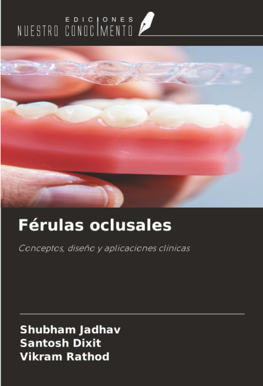 Ediciones Nuestro Conocimiento Férulas Oclusales: Conceptos, Diseño Y Aplicaciones Clínicas