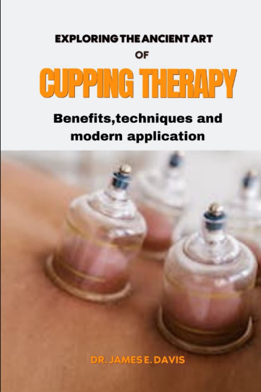 EXPLORING THE ANCIENT ART OF CUPPING THERAPY: BENEFITS,TECHNIQUES, AND MODERN APPLICATION
